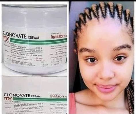 It is slightly milder than hydroquinone, but in combination with retinoids has been as effective as 4 hydroquinone, with less side effects. . Best natural skin lightening cream without side effects